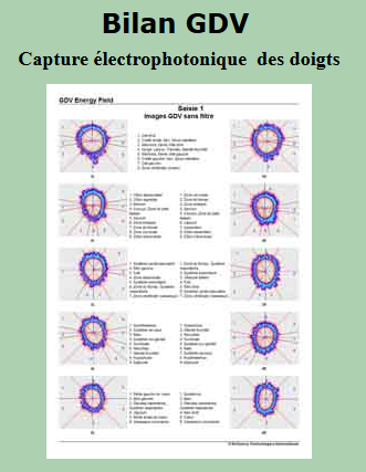 Kirlian 8